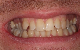 Smile Gallery - Church Road Dental and Cosmetic