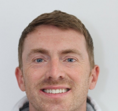 Smile Gallery - Church Road Dental and Cosmetic