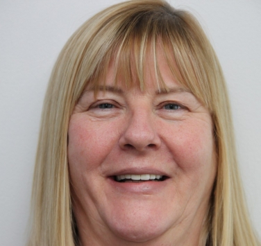 Smile Gallery - Church Road Dental and Cosmetic