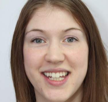 Smile Gallery - Church Road Dental and Cosmetic