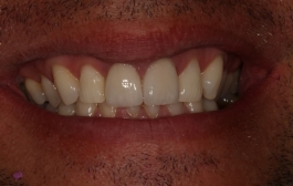Smile Gallery - Church Road Dental and Cosmetic