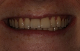 Smile Gallery - Church Road Dental and Cosmetic