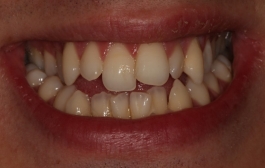 Smile Gallery - Church Road Dental and Cosmetic