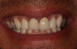 Smile Gallery - Church Road Dental and Cosmetic