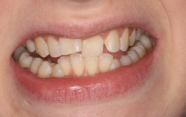 Smile Gallery - Church Road Dental and Cosmetic