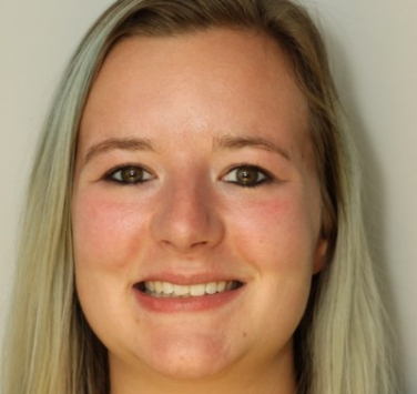 Smile Gallery - Church Road Dental and Cosmetic