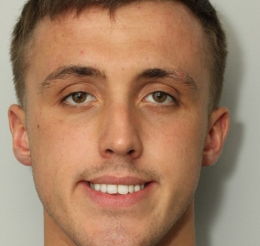 Smile Gallery - Church Road Dental and Cosmetic