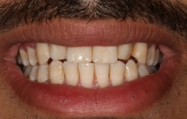 Smile Gallery - Church Road Dental and Cosmetic