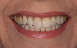 Smile Gallery - Church Road Dental and Cosmetic