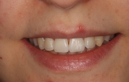 Smile Gallery - Church Road Dental and Cosmetic