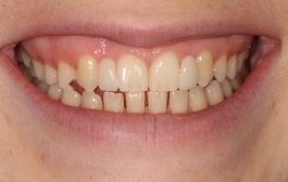 Smile Gallery - Church Road Dental and Cosmetic