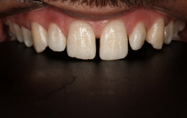 Smile Gallery - Church Road Dental and Cosmetic