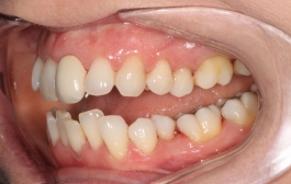 Smile Gallery - Church Road Dental and Cosmetic