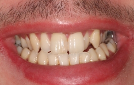 Smile Gallery - Church Road Dental and Cosmetic