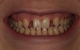 Smile Gallery - Church Road Dental and Cosmetic