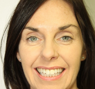 Smile Gallery - Church Road Dental and Cosmetic