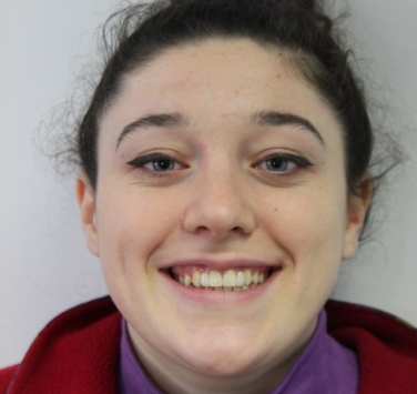 Smile Gallery - Church Road Dental and Cosmetic