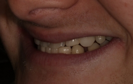 Smile Gallery - Church Road Dental and Cosmetic