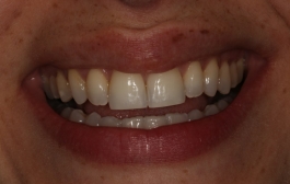 Smile Gallery - Church Road Dental and Cosmetic