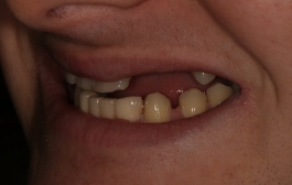 Smile Gallery - Church Road Dental and Cosmetic