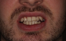 Smile Gallery - Church Road Dental and Cosmetic