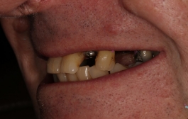 Smile Gallery - Church Road Dental and Cosmetic
