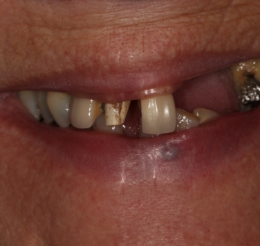 Smile Gallery - Church Road Dental and Cosmetic