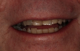 Smile Gallery - Church Road Dental and Cosmetic