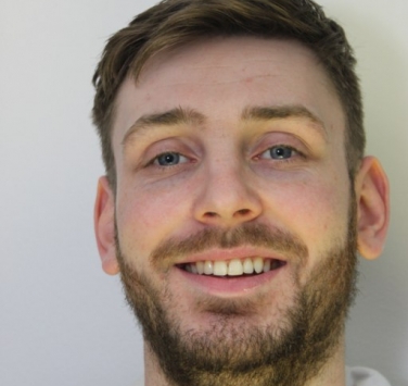 Smile Gallery - Church Road Dental and Cosmetic