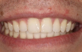 Smile Gallery - Church Road Dental and Cosmetic