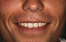 Smile Gallery - Church Road Dental and Cosmetic
