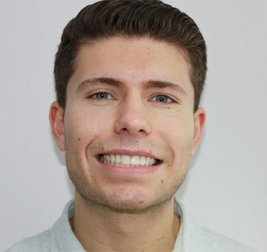 Smile Gallery - Church Road Dental and Cosmetic