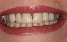 Smile Gallery - Church Road Dental and Cosmetic
