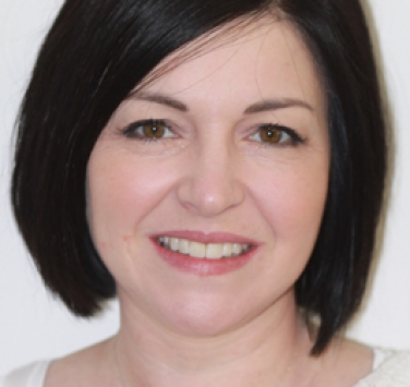 Smile Gallery - Church Road Dental and Cosmetic