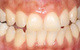 Smile Gallery - Church Road Dental and Cosmetic