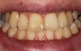 Smile Gallery - Church Road Dental and Cosmetic