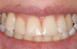 Smile Gallery - Church Road Dental and Cosmetic