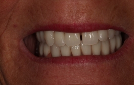 Smile Gallery - Church Road Dental and Cosmetic