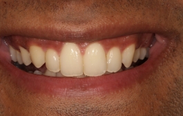 Smile Gallery - Church Road Dental and Cosmetic