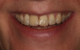 Smile Gallery - Church Road Dental and Cosmetic