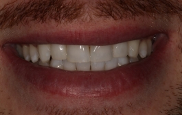 Smile Gallery - Church Road Dental and Cosmetic