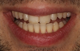 Smile Gallery - Church Road Dental and Cosmetic