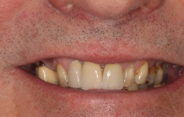 Smile Gallery - Church Road Dental and Cosmetic