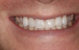 Smile Gallery - Church Road Dental and Cosmetic