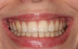 Smile Gallery - Church Road Dental and Cosmetic