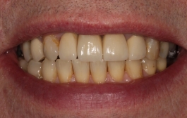 Smile Gallery - Church Road Dental and Cosmetic