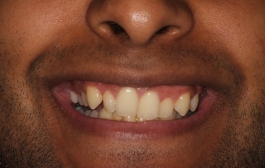 Smile Gallery - Church Road Dental and Cosmetic