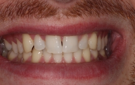 Smile Gallery - Church Road Dental and Cosmetic