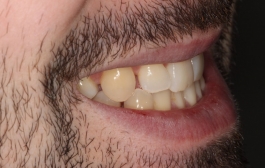 Smile Gallery - Church Road Dental and Cosmetic