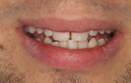 Smile Gallery - Church Road Dental and Cosmetic